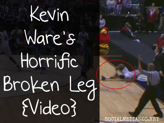 Kevin Ware Broken Leg Video - Louisville Basketball Player Injury