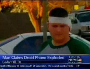 Android Phone Explodes In Man's Ear, 4 Stitches Needed (Video) SMSEO