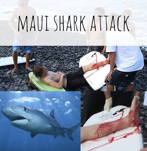 maui shark attack