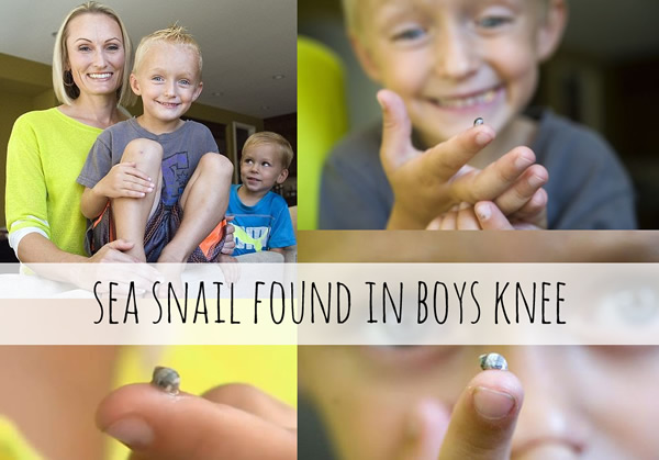 sea snail boys knee hatched