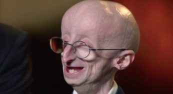 The Amazing Sam Berns, 17 Year Old with Rare Disease Dies